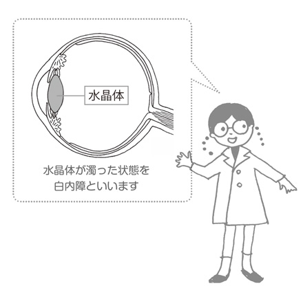 水晶体が濁った状態を
白内障といいます